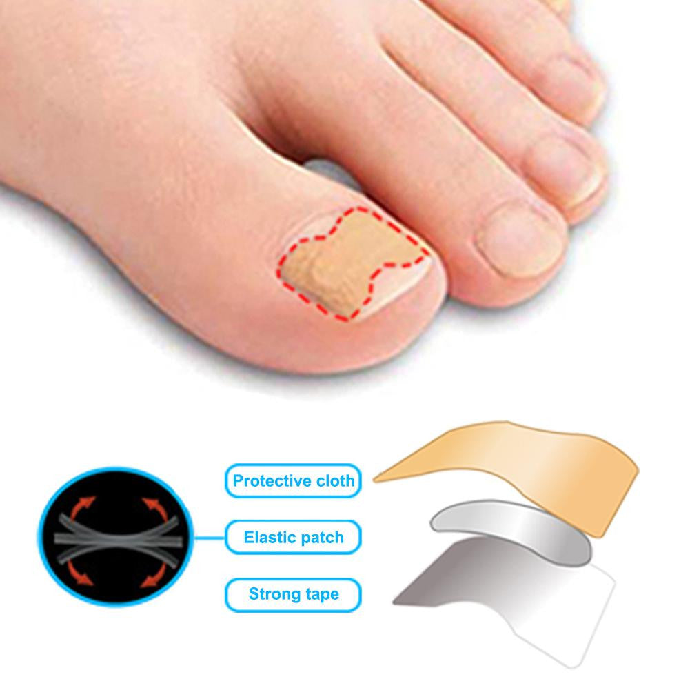 Parches Nails Corrector™
